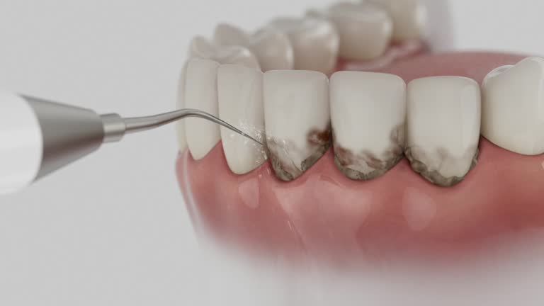Trusted Teeth Cleaning And Checkup service in Anderson, MO - Dentist Open Now